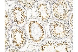 ABIN7094745 and ABIN7098796 at 1/100 staining Rat testis tissue by IHC-P.