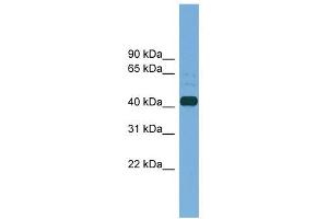 PLAT antibody used at 1 ug/ml to detect target protein. (PLAT anticorps  (Middle Region))