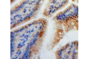 IHC-P analysis of Stomach tissue, with DAB staining. (FABP2 anticorps  (AA 2-132))