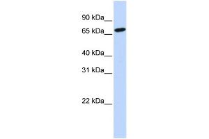 WB Suggested Anti-HAL Antibody Titration:  1 ug/ml  Positive Control:  721_B cell lysate (HAL anticorps  (N-Term))