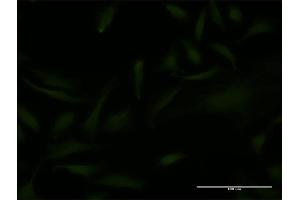 Immunofluorescence of monoclonal antibody to EMX2 on HeLa cell. (EMX2 anticorps  (AA 103-200))