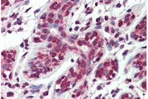 Human Breast: Formalin-Fixed, Paraffin-Embedded (FFPE) (ARL2 anticorps  (AA 123-184))