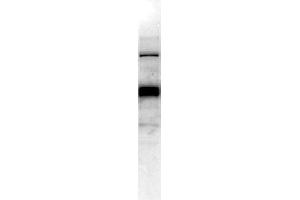 Western blot analysis on A549 human lung cancer cell lysate using human lumican antibody.