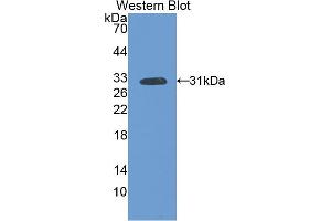 Western blot analysis of the recombinant protein. (FLT1 anticorps  (AA 303-524))