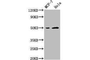 Western Blot Positive WB detected in: MCF-7 whole cell lysate, Hela whole cell lysate All lanes: SLC16A3 antibody at 1:2500 Secondary Goat polyclonal to rabbit IgG at 1/50000 dilution Predicted band size: 50 kDa Observed band size: 50 kDa