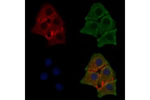 ABIN6255818 and ABIN6267580 staining HepG2 cells(30 min of 4uM Forskolin treatment) by IF/ICC.