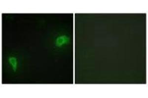 Immunofluorescence analysis of HepG2 cells, using DOK7 antibody. (DOK7 anticorps  (N-Term))