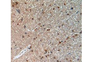 Used in DAB staining on fromalin fixed paraffin- embedded spinal cord tissue (MFAP2 anticorps  (AA 8-171))