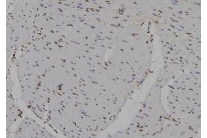 ABIN6277154 at 1/100 staining Human gastric tissue by IHC-P. (IRF3 anticorps  (C-Term))