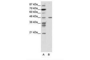 Image no. 1 for anti-Proteasome (Prosome, Macropain) 26S Subunit, ATPase, 2 (PSMC2) (N-Term) antibody (ABIN343937) (PSMC2 anticorps  (N-Term))