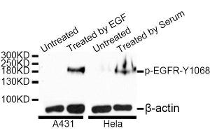 Western blot analysis of extracts of A-431 and HeLa cells, using Phospho-EGFR-Y1068 antibody.