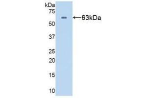 Western blot analysis of recombinant Human HSPD1. (HSPD1 anticorps  (AA 1-573))
