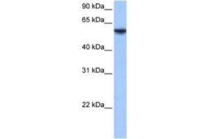 Western Blotting (WB) image for anti-Inositol-3-Phosphate Synthase 1 (ISYNA1) antibody (ABIN2463597)