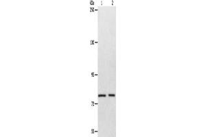 Gel: 8 % SDS-PAGE, Lysate: 40 μg, Lane 1-2: Mouse liver tissue, SP20 cells, Primary antibody: ABIN7128119(ABCB6 Antibody) at dilution 1/320, Secondary antibody: Goat anti rabbit IgG at 1/8000 dilution, Exposure time: 1 minute (ABCB6 anticorps)