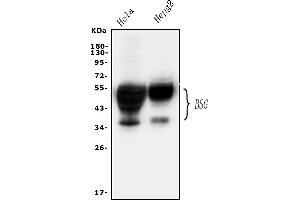 Western blot analysis of CD147/Emmprin using anti-CD147/Emmprin antibody (ABIN5518743).