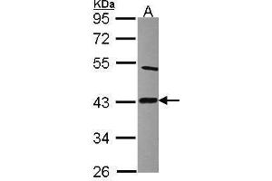 WB Image Sample (30 ug of whole cell lysate) A: Raji 10% SDS PAGE antibody diluted at 1:2000 (LIAS anticorps)