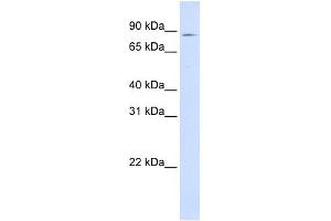 CPT1A antibody used at 1 ug/ml to detect target protein. (CPT1A anticorps)