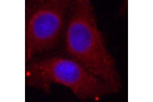 Immunofluorescence staining of methanol-fixed HeLa cells using Phospho-GAP43-S41 antibody (ABIN2988022). (GAP43 anticorps  (pSer41))