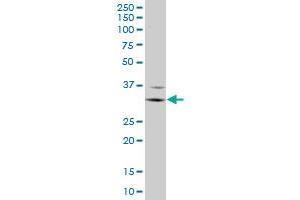 FCGR3A monoclonal antibody (M03A), clone 2B11.