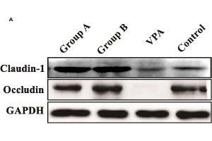 Expression of claudin-1 and occludin in the colonic tissues of different groups.
