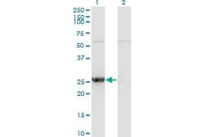 Western Blot analysis of TK1 expression in transfected 293T cell line by TK1 monoclonal antibody (M07), clone 3G10. (TK1 anticorps  (AA 1-234))