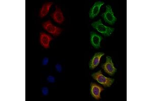 ABIN7094622 and ABIN7098672 staining Hela cells by IF/ICC.