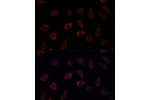 Immunofluorescence analysis of L929 cells using DUSP8 antibody (ABIN7266849) at dilution of 1:100. (DUSP8 anticorps)