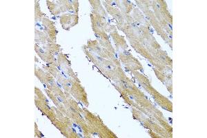 Immunohistochemistry of paraffin-embedded rat heart using SRI antibody  at dilution of 1:100 (40x lens).
