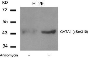 Western blot analysis of extracts from HT29 cells untreated or treated with Anisomycin using GATA1(Phospho-Ser310) Antibody. (GATA1 anticorps  (pSer310))