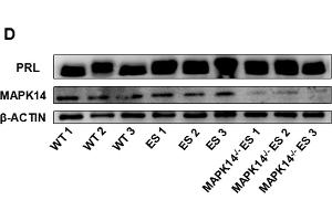 Effects of MAPK14 knockout on the development of prolactinoma in ES-induced mice. (beta Actin anticorps)