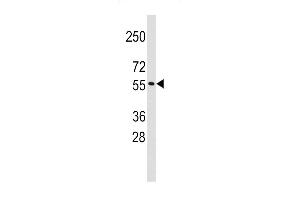 Western blot analysis of anti-TRIM69 Antibody (Center ) (R) in K562 cell line lysates (35 μg/lane).
