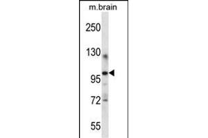 ITCH Antibody (Center) (ABIN657549 and ABIN2846563) western blot analysis in mouse brain tissue lysates (35 μg/lane). (ITCH anticorps  (AA 509-536))