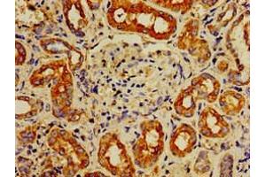 Immunohistochemistry of paraffin-embedded human kidney tissue using ABIN7143048 at dilution of 1:100 (IPP anticorps  (AA 444-515))