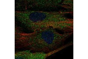 Immunofluorescent staining of BJ cells with ALPK2 polyclonal antibody  (Green) shows localization to cytosol. (ALPK2 anticorps)