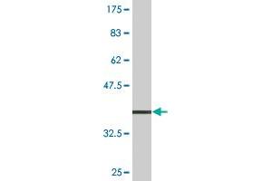 Western Blot detection against Immunogen (37.