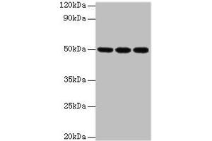 Western blot All lanes: HAT1 antibody at 3 μg/mL Lane 1: MCF-7 whole cell lysate Lane 2: 293T whole cell lysate Lane 3: HepG2 whole cell lysate Secondary Goat polyclonal to rabbit at 1/10000 dilution Predicted band size: 50, 40 kDa Observed band size: 50 kDa (HAT1 anticorps  (Catalytic Subunit))