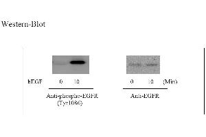 Image no. 6 for Epidermal Growth Factor Receptor (EGFR) ELISA Kit (ABIN625237) (EGFR Kit ELISA)