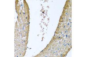 Immunohistochemistry of paraffin-embedded mouse heart using COX5B antibody (ABIN5974711) at dilution of 1/100 (40x lens).