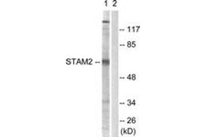 Western blot analysis of extracts from NIH-3T3 cells, treated with EGF 200ng/ml 30', using STAM2 (Ab-192) Antibody. (STAM2 anticorps  (AA 161-210))