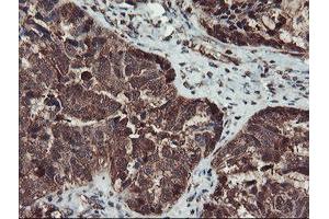 Image no. 12 for anti-serpin Peptidase Inhibitor, Clade B (Ovalbumin), Member 1 (SERPINB1) (AA 77-306) antibody (ABIN1491671)