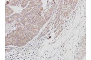 IHC-P Image Immunohistochemical analysis of paraffin-embedded SAS xenograft, using BTK, antibody at 1:100 dilution.