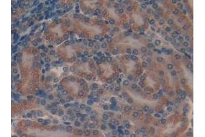 Detection of MYO1A in Mouse Kidney Tissue using Polyclonal Antibody to Myosin IA (MYO1A) (Myosin IA anticorps  (AA 783-1043))