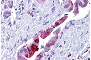 Human Pancreas, Duct: Formalin-Fixed, Paraffin-Embedded (FFPE) (Retinoblastoma Binding Protein 8 anticorps  (Internal Region))