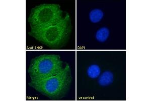 ABIN334464 Immunofluorescence analysis of paraformaldehyde fixed U2OS cells, permeabilized with 0. (SNX9 anticorps  (Internal Region))