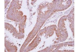 Image no. 1 for anti-Myotubularin Related Protein 9 (MTMR9) (AA 254-428) antibody (ABIN1499593)