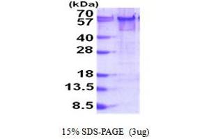 YY1 Transcription Factor (YY1) (AA 1-414) protein (His tag)