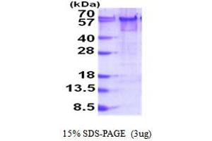 SDS-PAGE (SDS) image for YY1 Transcription Factor (YY1) (AA 1-414) protein (His tag) (ABIN5853933) (YY1 Protein (AA 1-414) (His tag))
