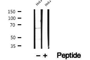 Western blot analysis of extracts of HeLa cells, using TSHR antibody.