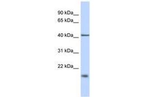 Image no. 1 for anti-TBC1 Domain Family, Member 21 (TBC1D21) (N-Term) antibody (ABIN6743256) (TBC1D21 anticorps  (N-Term))