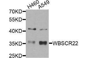 Western blot analysis of extracts of H460 and A549 cells, using WBSCR22 antibody. (WBSCR22 anticorps)
